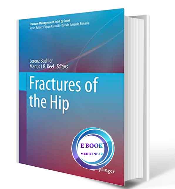 دانلود کتابFractures of the Hip (Fracture Management Joint by Joint) 1st ed. 2019( PDF)